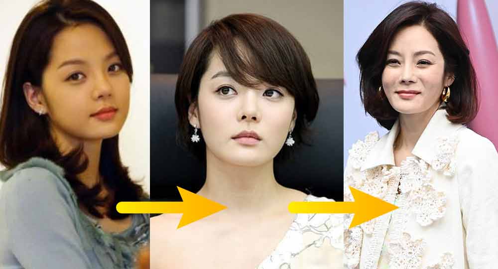Actrices coreanas que han sido criticadas por tener mucha cirugía plástica 7 Chae Rim antes y despues