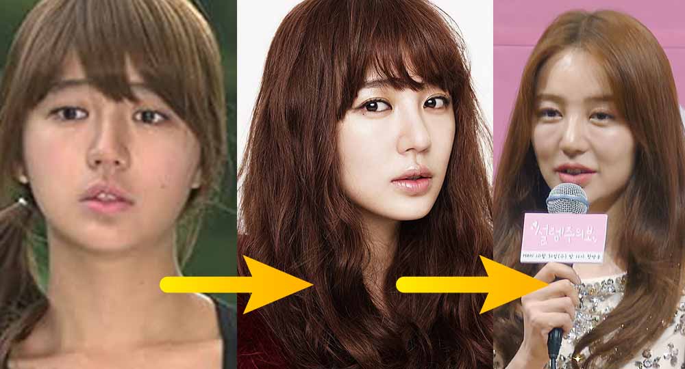 Actrices coreanas que han sido criticadas por tener mucha cirugía plástica 4 Yoon Eun Hye antes y despues