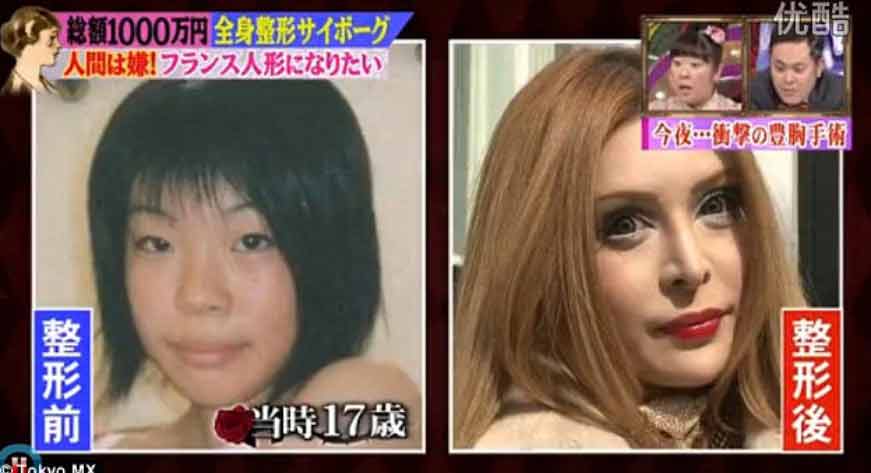 Increíble transformación: La japonesa que invirtió más de 2 millones de dólares para parecer una muñeca francesa 2 La japonesa que invirtió más de 2 millones de dólares para parecer una muñeca francesa